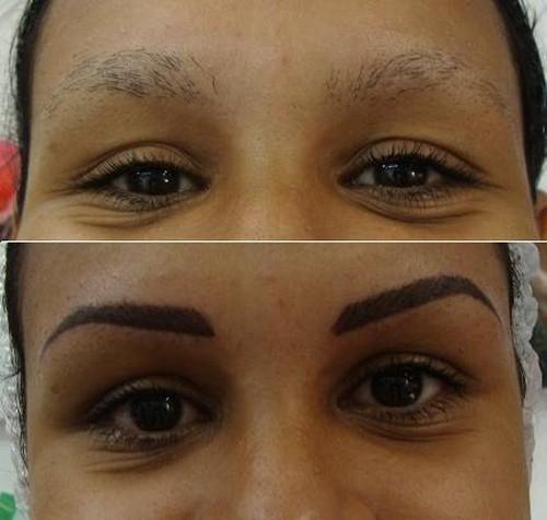 Micropigmentação antes e depois